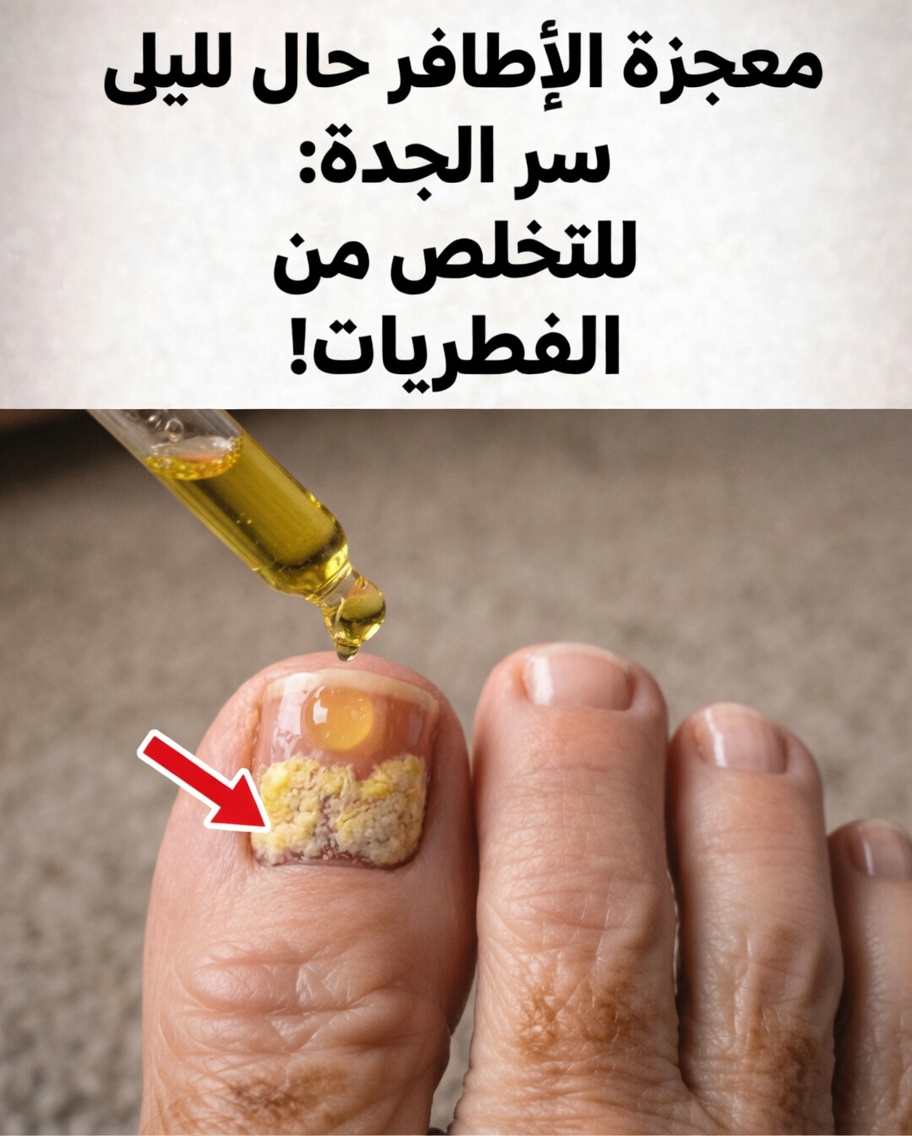 طقس بسيط لـ"توابل الأظافر" باستخدام الثوم قد يدعم صحة أظافر القدم بشكل طبيعي