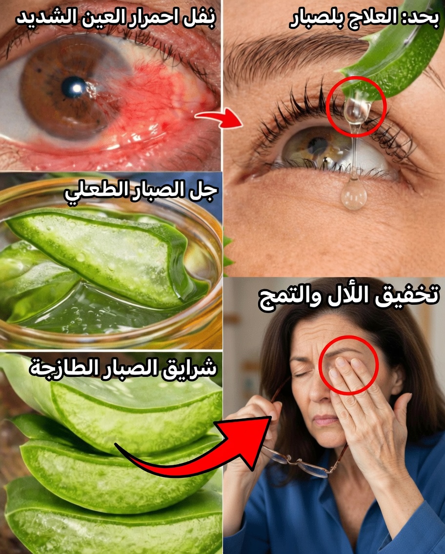الألوة فيرا لراحة العين اليومية: استكشاف طرق طبيعية لتهدئة الاحمرار والجفاف والتهيج في المنزل