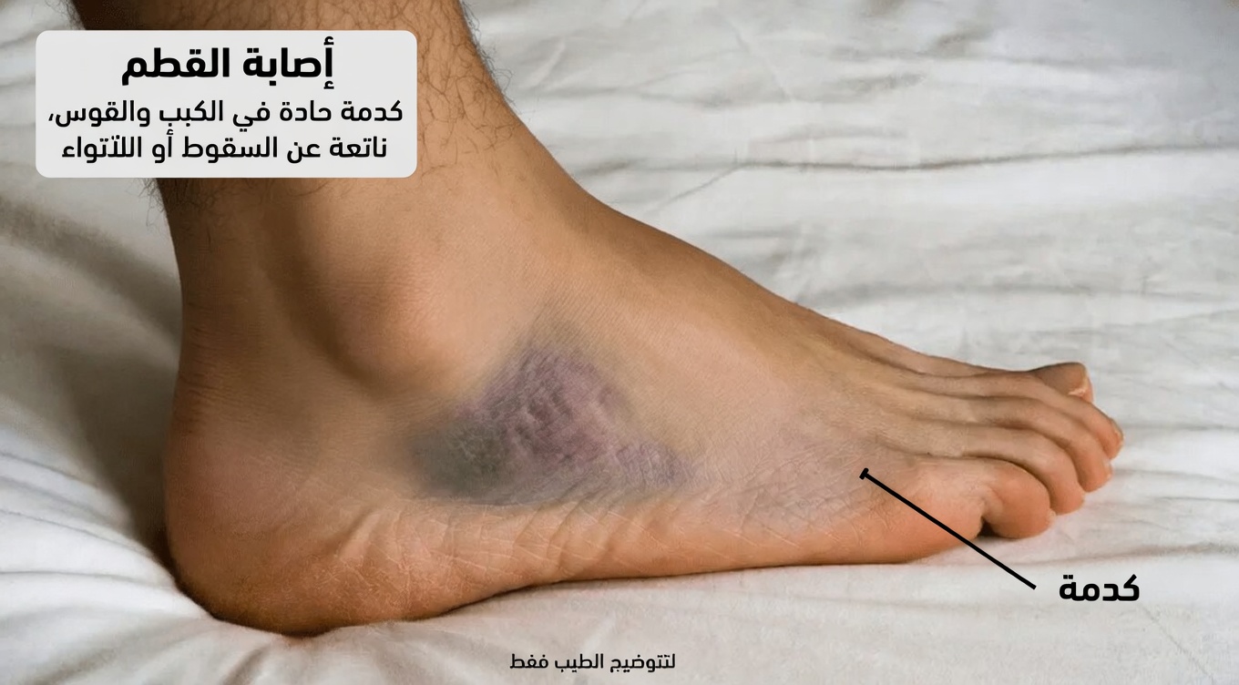 15 علامة تحذيرية لتلف الكلى يجب أن تعرفها لدعم صحتك العامة