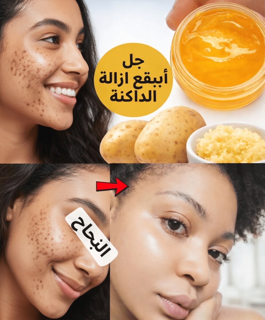 اكتشف سر المطبخ: كيف يمكن للبطاطس والزنجبيل أن يسهما في بشرة أكثر إشراقًا وتجانسًا في اللون
