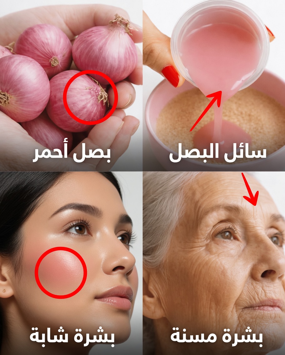 البصل الأحمر للوجه: الحيلة الطبيعية من المطبخ التي يستكشفها الآلاف لبشرة مشرقة ومتجانسة اللون