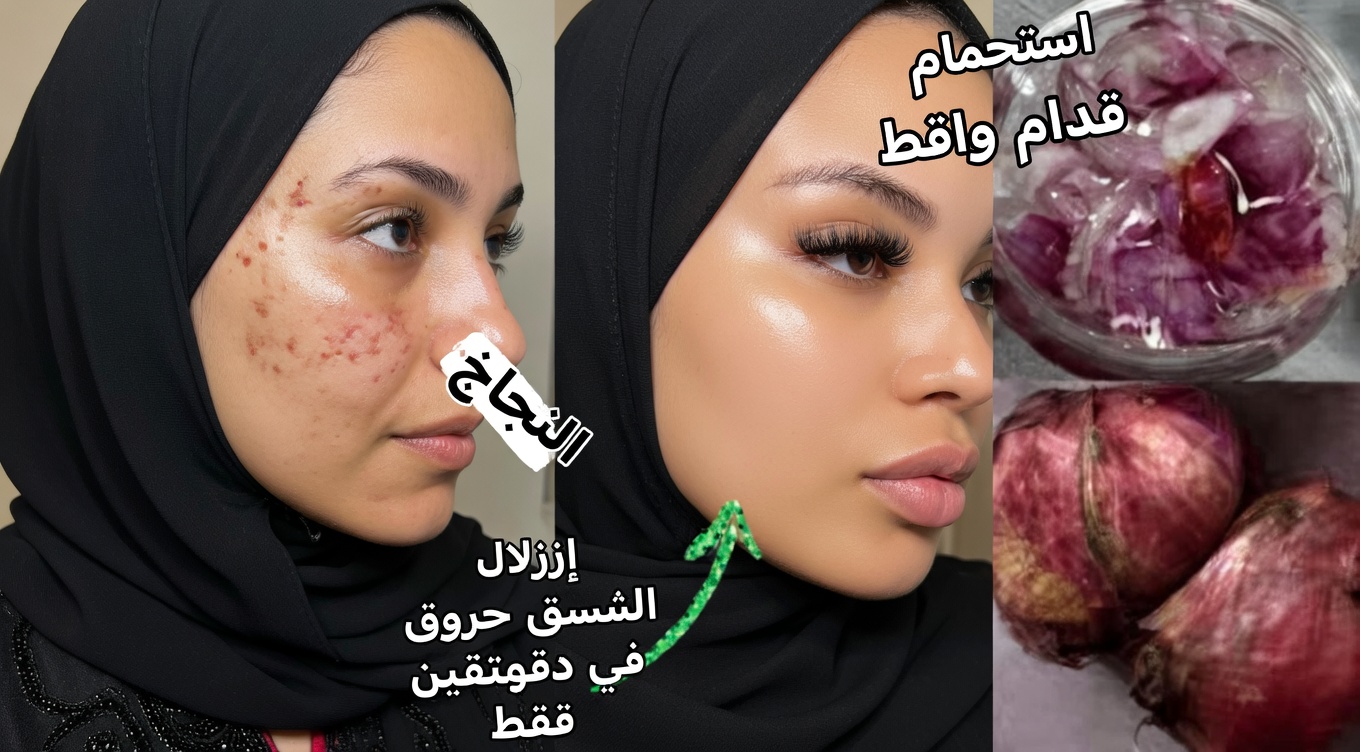 البصل الأحمر للوجه: الحيلة الطبيعية من المطبخ التي يستكشفها الآلاف لبشرة مشرقة ومتجانسة اللون