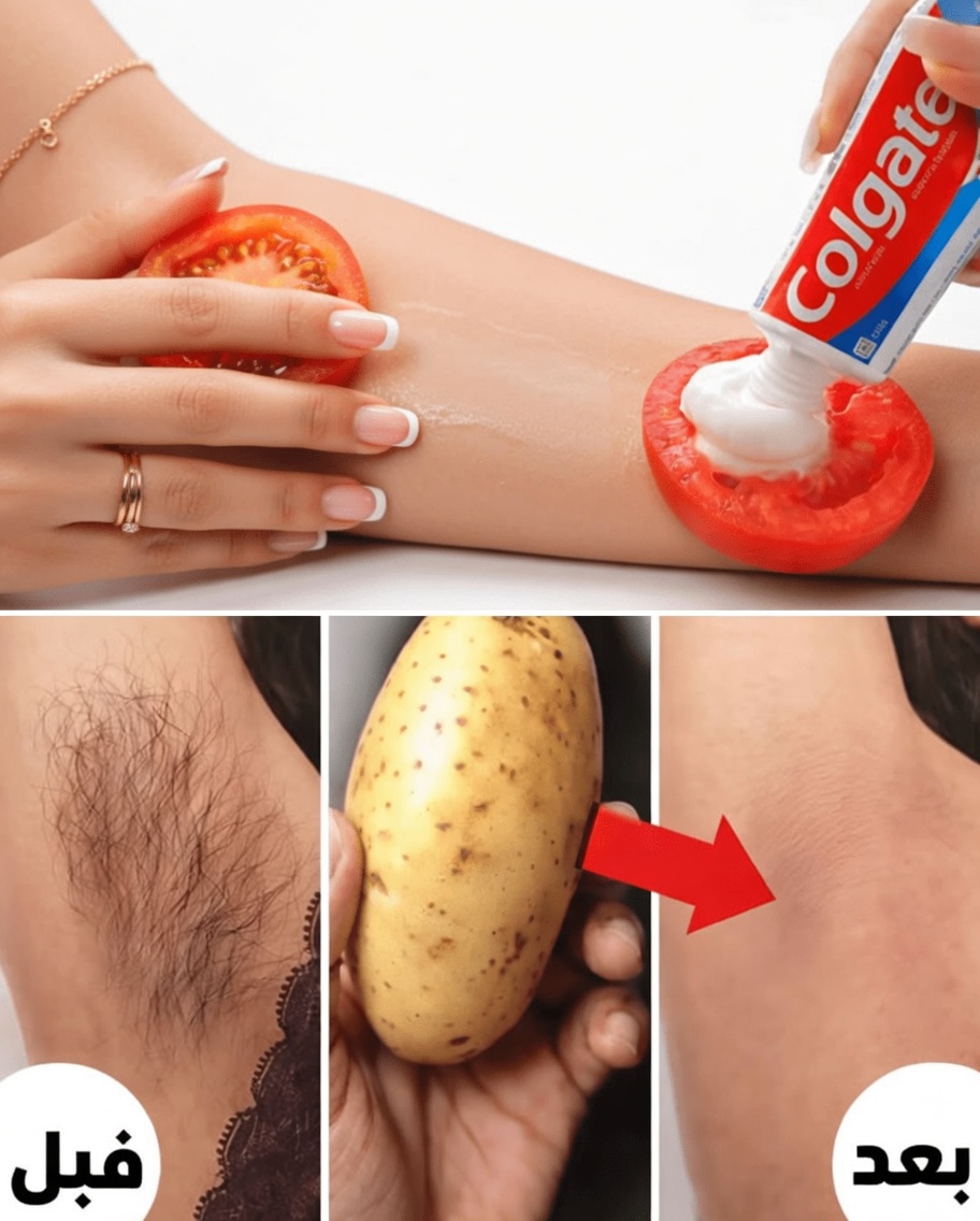 سئمتِ من الحلاقة المتكررة؟ 15 طريقة طبيعية للمساعدة في تقليل نمو الشعر غير المرغوب فيه في المنزل