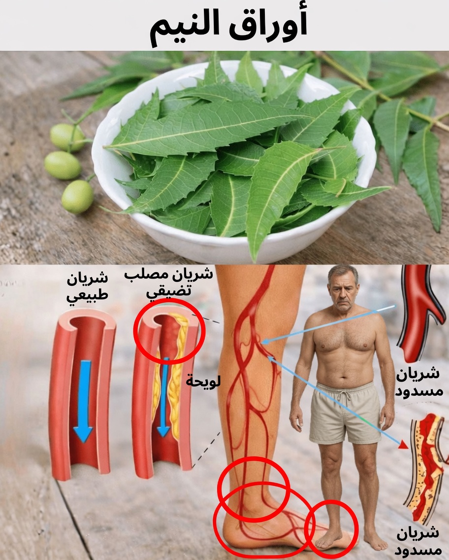 اكتشف كيف يمكن لأوراق النيم أن تساعد في إدارة نسبة السكر في الدم، وضغط الدم، والألم، ومستويات الكوليسترول، والدورة الدموية