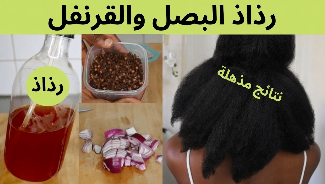 هل تعاني من ترقق الشعر؟ اكتشف بخاخًا طبيعيًا منزليًا لنمو الشعر بالبصل والقرنفل وإكليل الجبل والقهوة