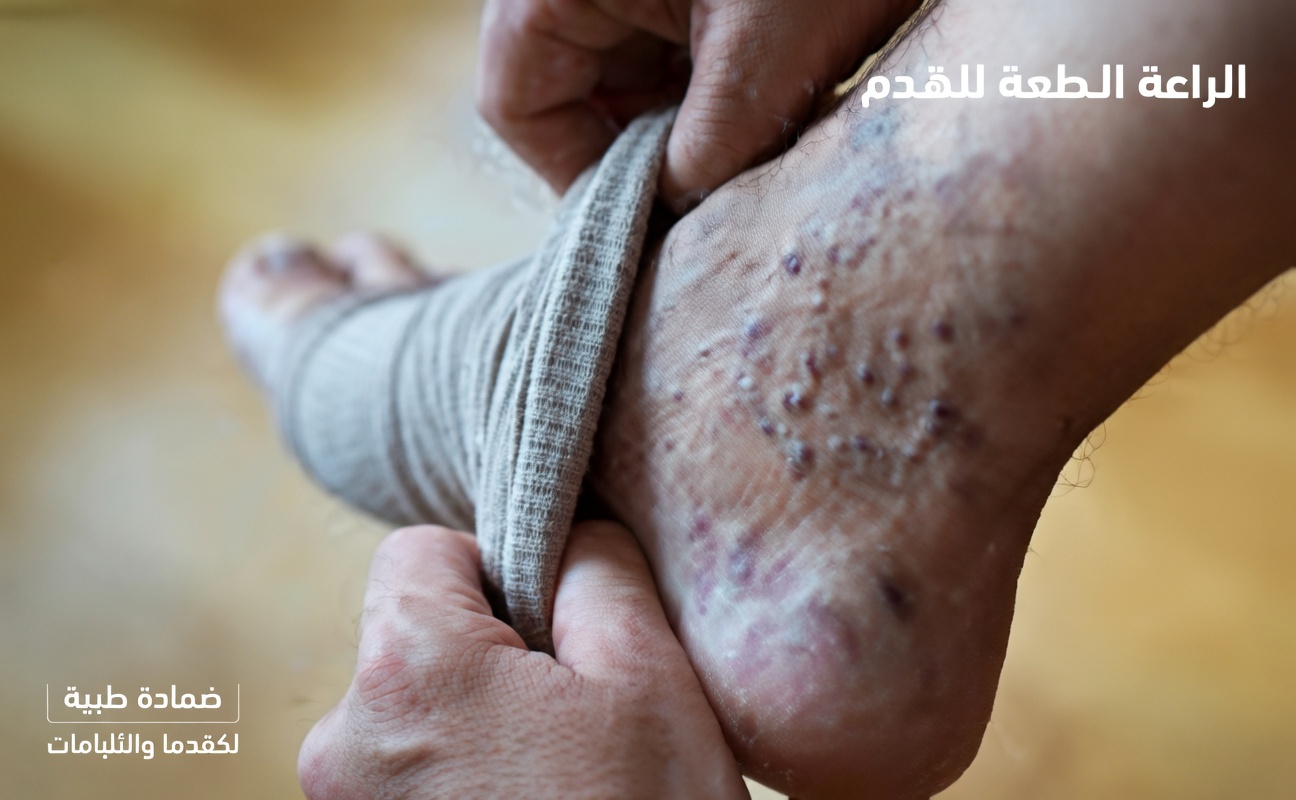 هل تعلم أن الثوم قد يساعد في تخفيف الانزعاج المصاحب لدوالي الأوردة وتقليل الالتهاب بشكل طبيعي؟