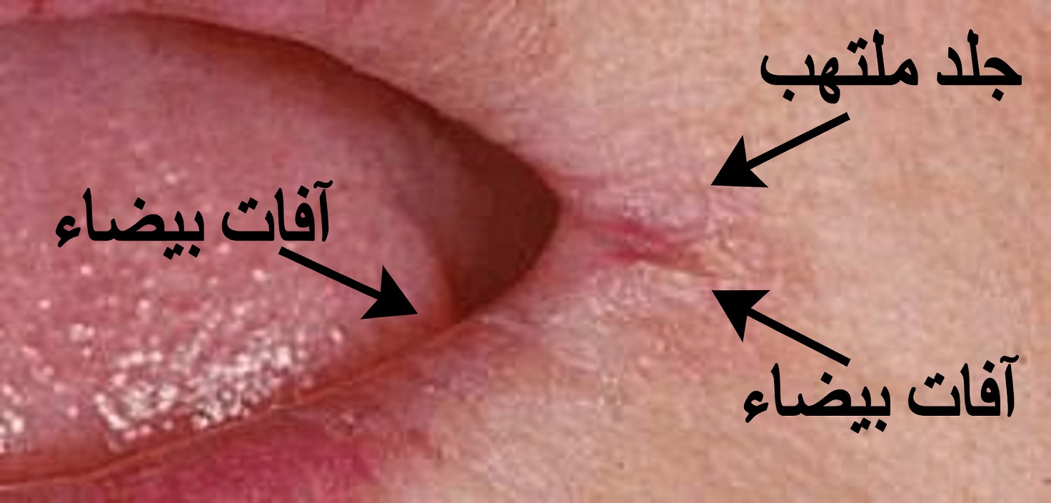 6 علامات تحذيرية في الجسم بعد سن الأربعين لا يجب تجاهلها
