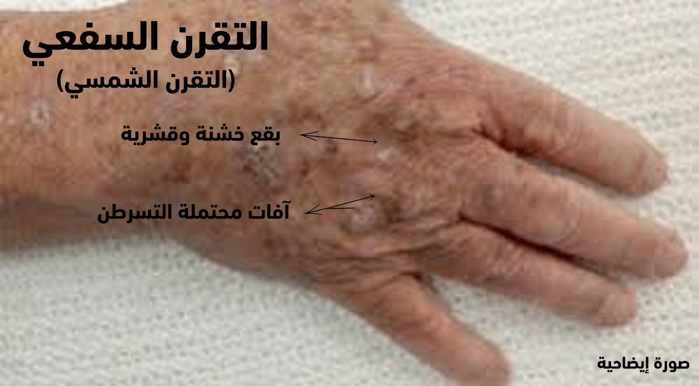 6 علامات تحذيرية في الجسم بعد سن الأربعين لا يجب تجاهلها