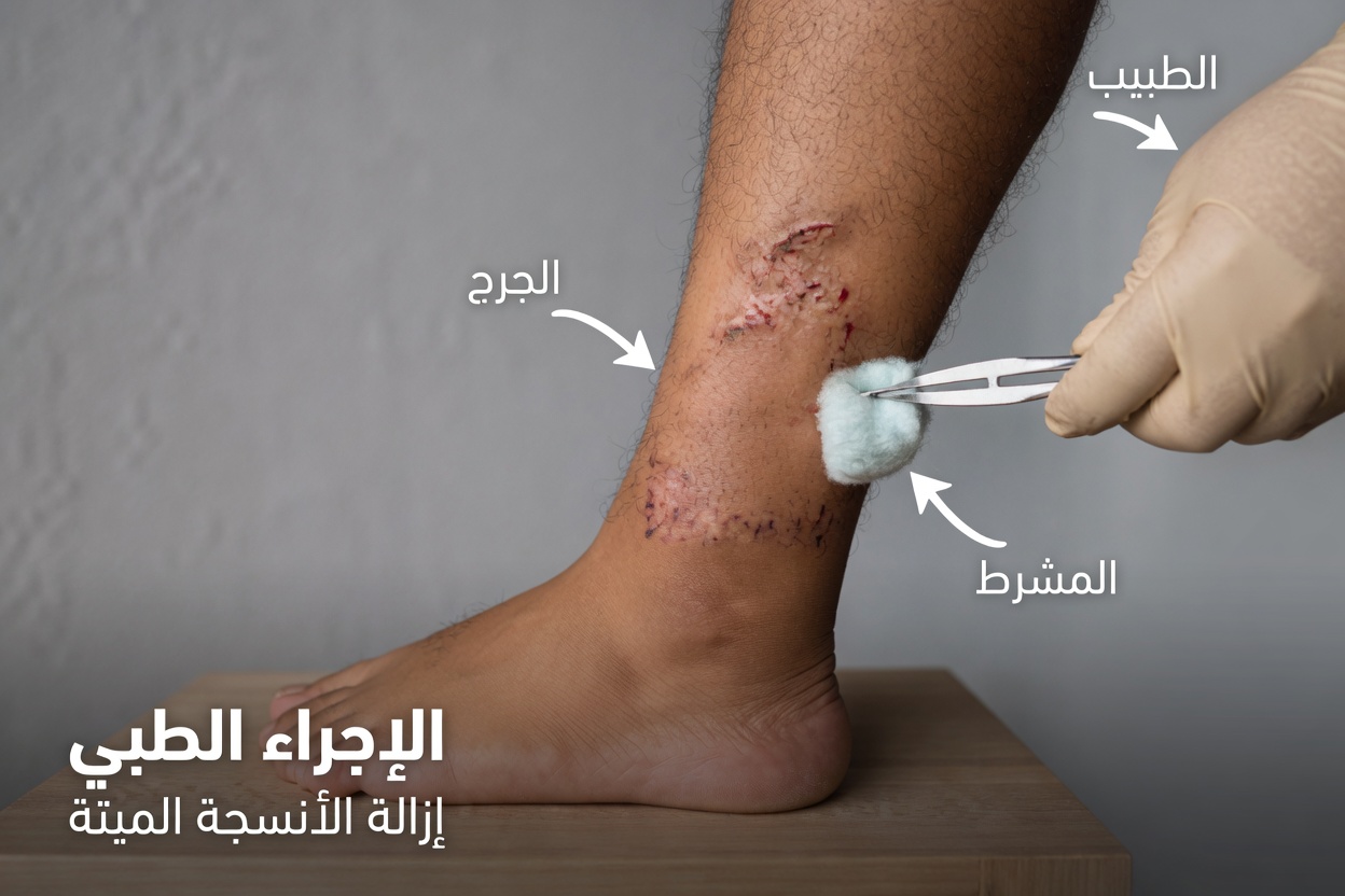 10 علامات خفية تدل على نقص فيتامين د لديك – لا تتجاهلها!