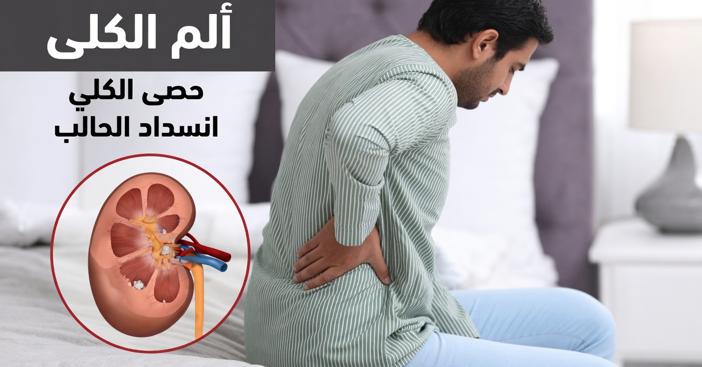 أعراض حصى الكلى – كل ما تحتاج إلى معرفته