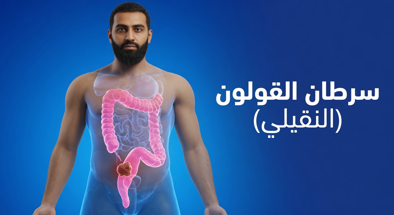 ٧ علامات تحذيرية خفية لسرطان القولون لا يجب تجاهلها أبدًا وكيف يمكن للوعي أن يمنحك القوة