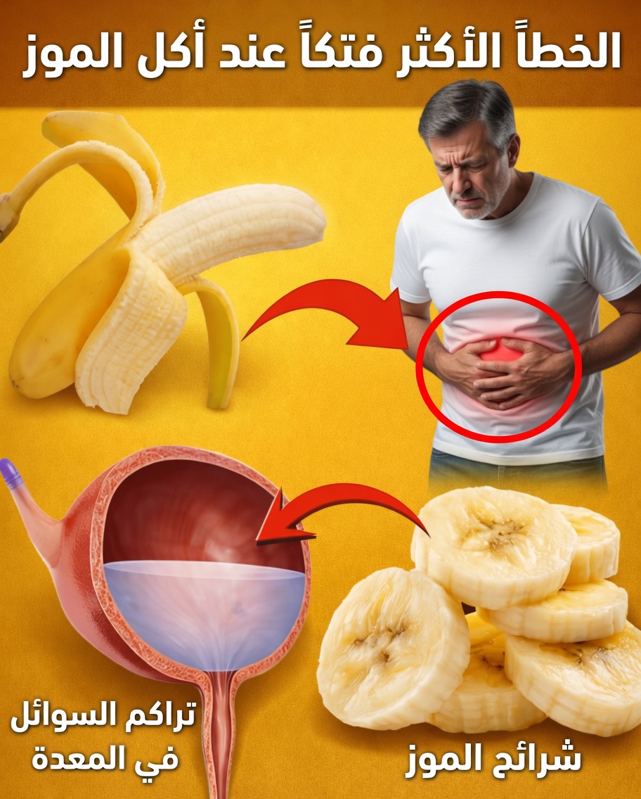 ٨ أخطاء جسيمة ترتكبها عند تناول الموز قد تؤثر على طاقتك اليومية وعملية الهضم