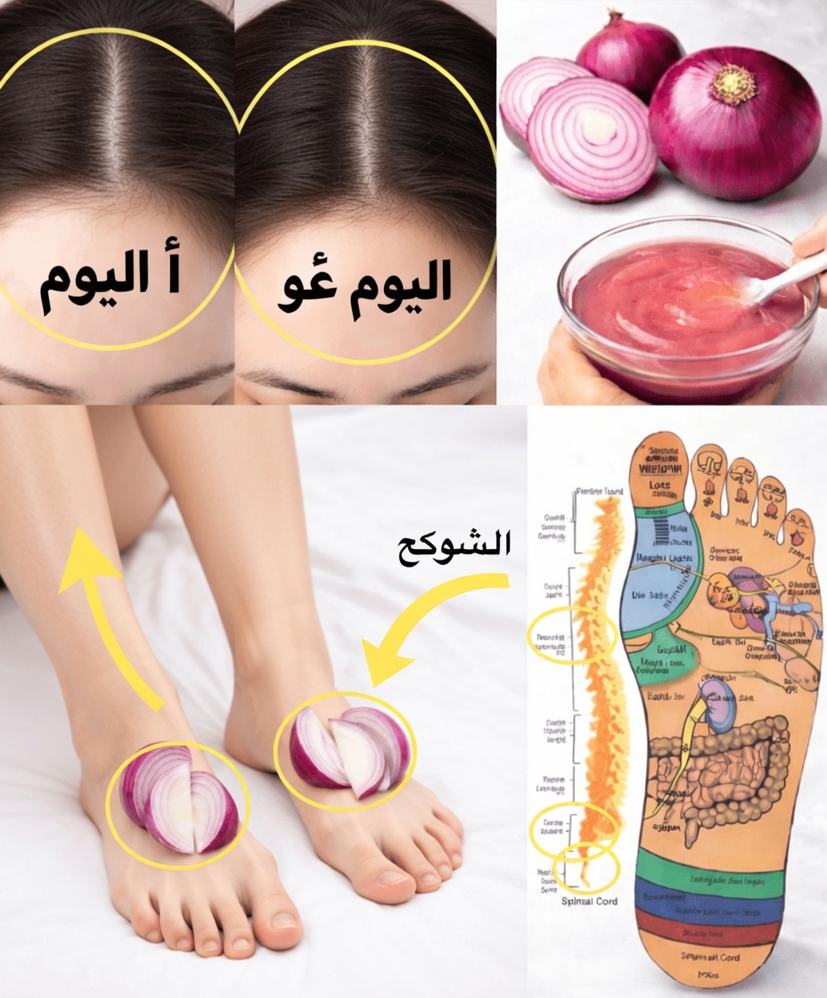 ١٤ طريقة مبتكرة يمكن للبصل من خلالها تحسين صحتك في المنزل