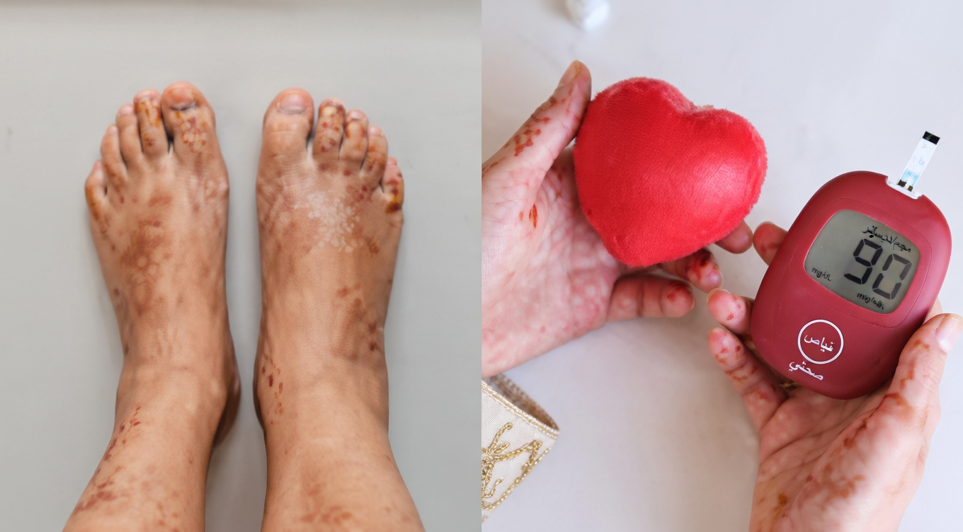 كبار السن، هل تهمس ساقاكُم بتحذيرات لا يمكنكم تجاهلها؟ 4 فيتامينات قد تدعم الدورة الدموية الصحية في الساقين