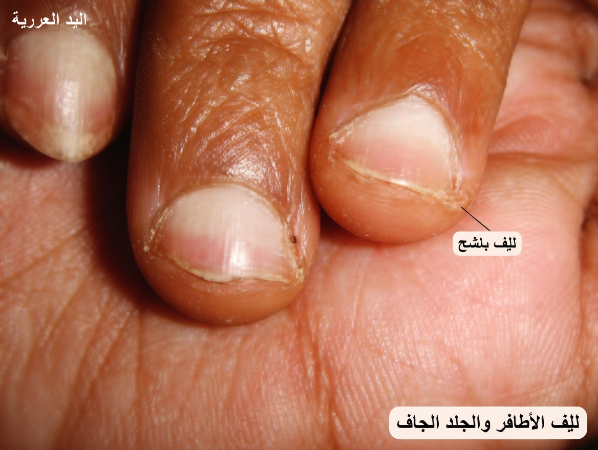 17 علامة خطيرة لمرض الكلى تظهر على جسمك – اكشفها قبل فوات الأوان