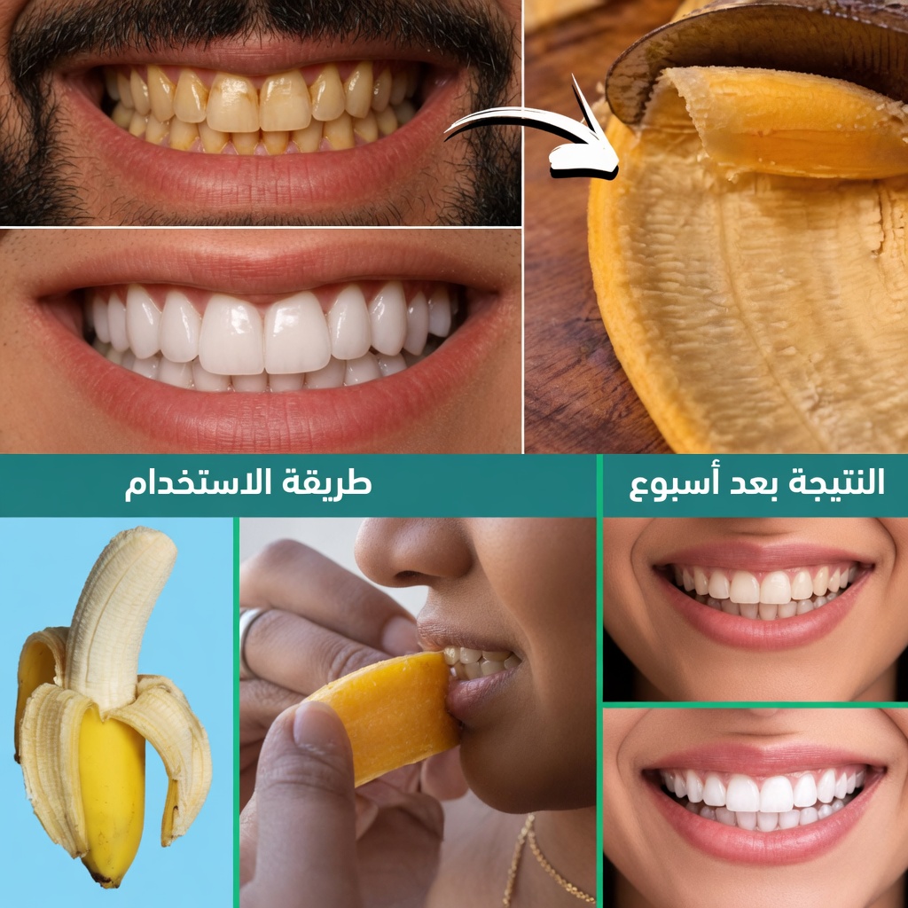 في دقيقتين فقط، أزل 10 سنوات من تصبغات الأسنان – المبيض الطبيعي الذي يعمل فعلاً