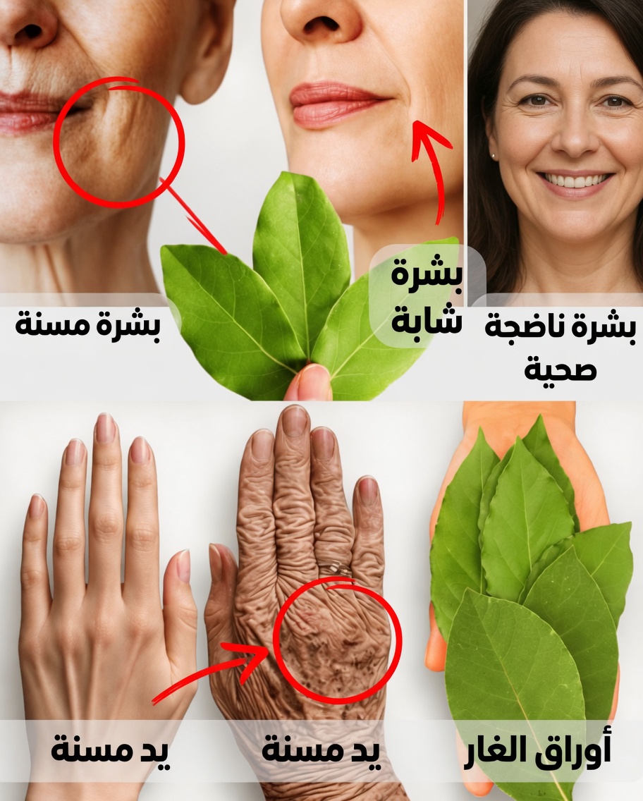 ورق الغار للتجاعيد: حقيقة أم خيال – هل يمكنه حقاً التفوق على البوتوكس؟