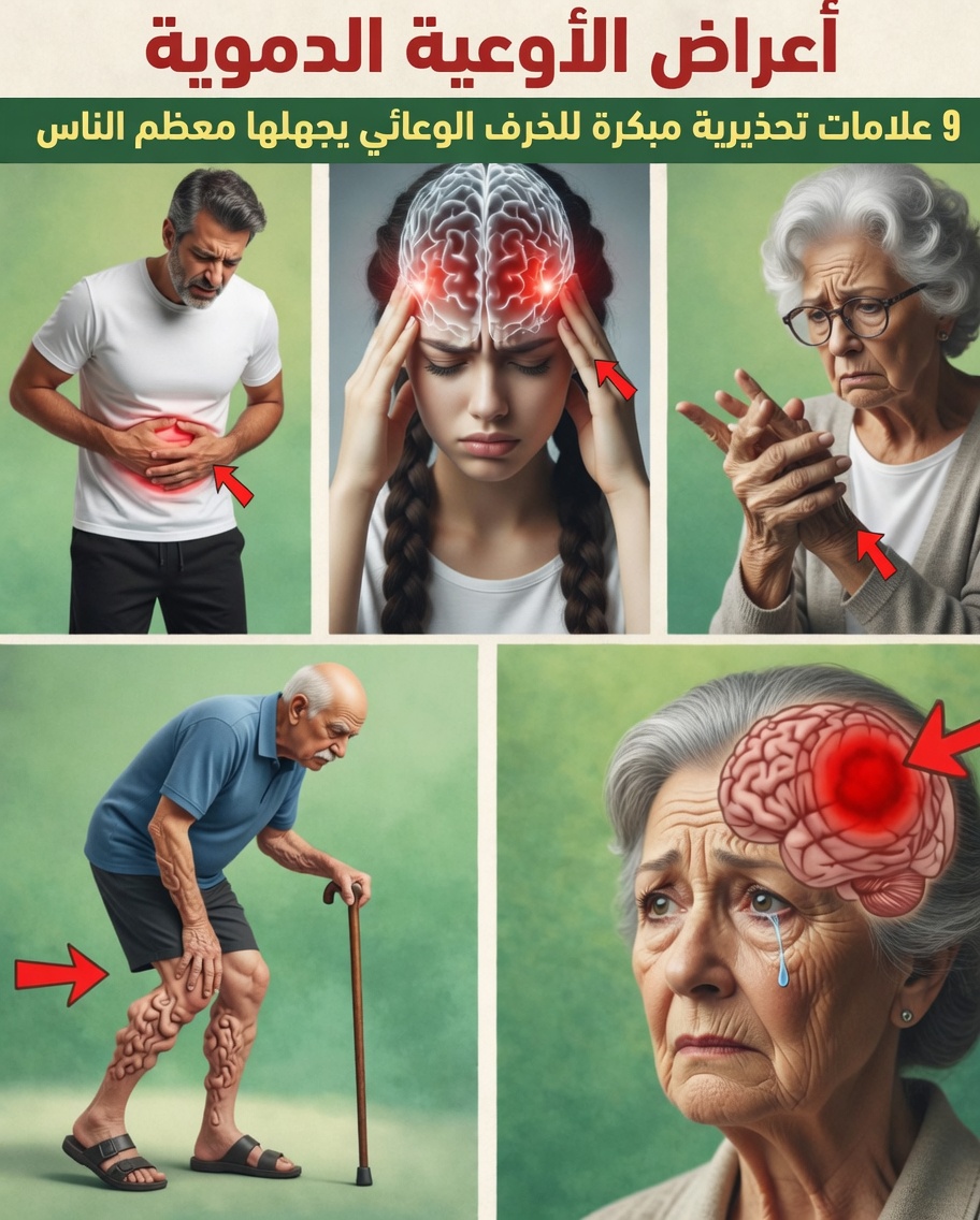 علامات مبكرة للخرف الوعائي (معظم الناس يغفلون الرقم 3) – ما الذي يخبرك به دماغك بهدوء قبل فوات الأوان