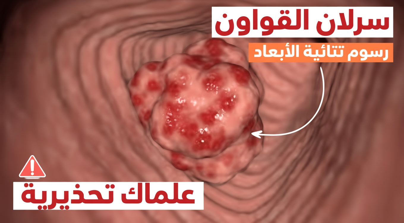 أعراض خطيرة لسرطان القولون لا يجب تجاهلها أبدًا – الكشف المبكر قد ينقذ حياتك