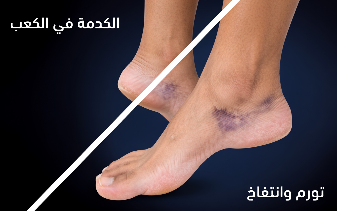 النساء فوق سن الستين: 10 علامات تحذيرية في الساق لا ينبغي تجاهلها – احذروا العلامة رقم 7!