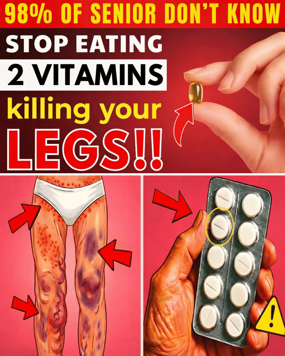 كبار السن: أسوأ فيتامينين يمكن أن يضعفا ساقيك بعد سن الستين (مع أطعمة يجب تجنبها)