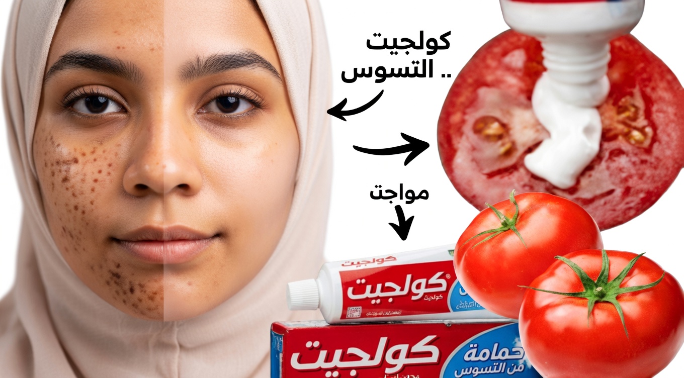 احصلي على بشرة خالية من العيوب طبيعيًا: قناع معجون الأسنان والطماطم الذي يستهدف المسام الواسعة والبقع الداكنة والشعر غير المرغوب فيه