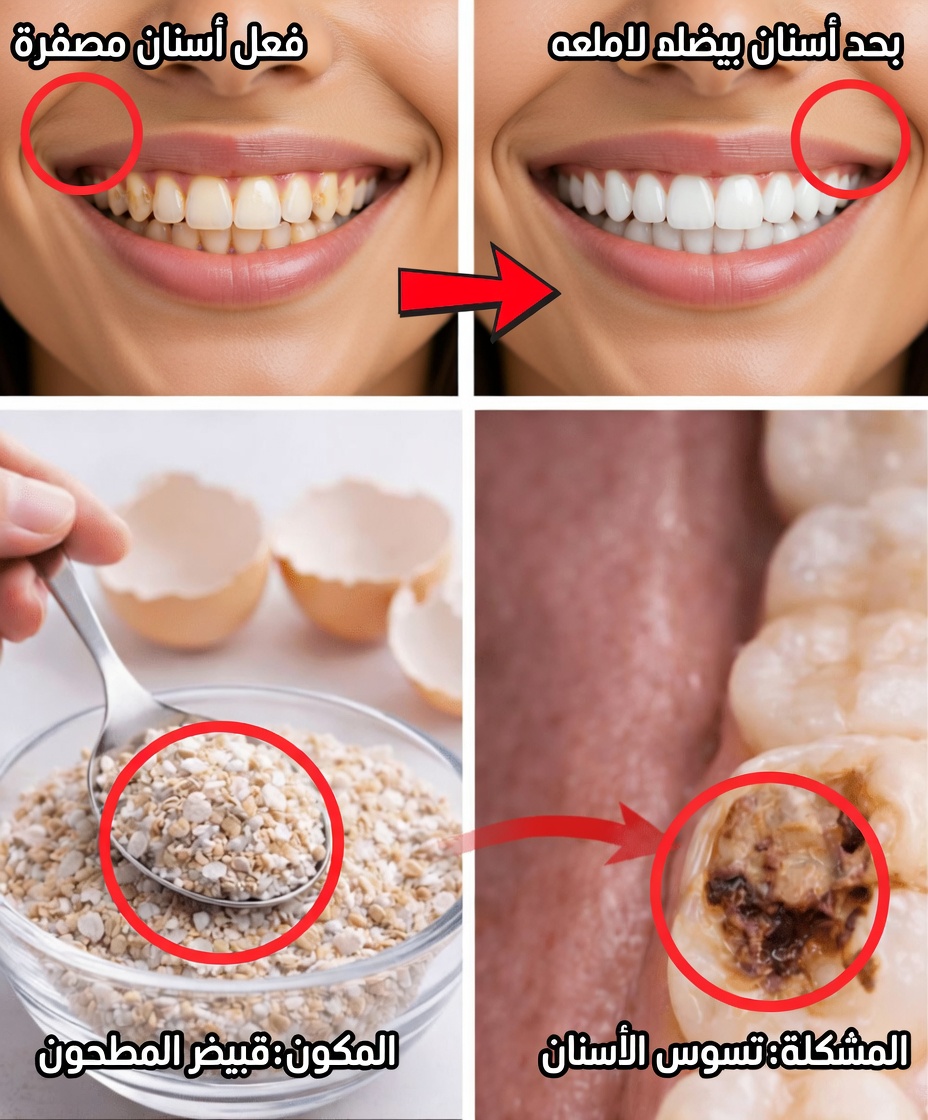 بودرة قشر البيض ومعجون الأسنان: احصل على أسنان خالية من الجير طبيعيًا في المنزل