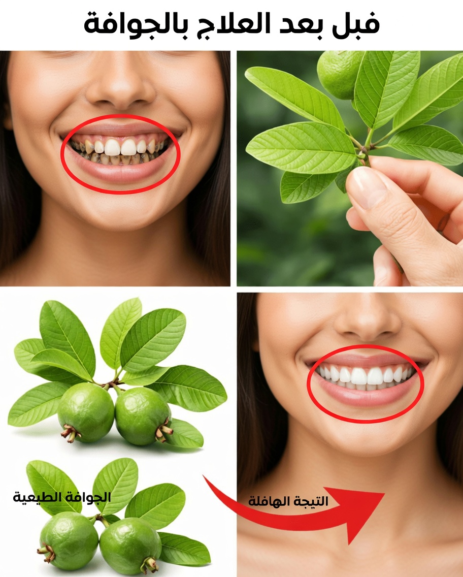 اكشف سر الطبيعة لابتسامتك: أفضل 3 علاجات بأوراق الجوافة لدعم العناية اليومية بالفم