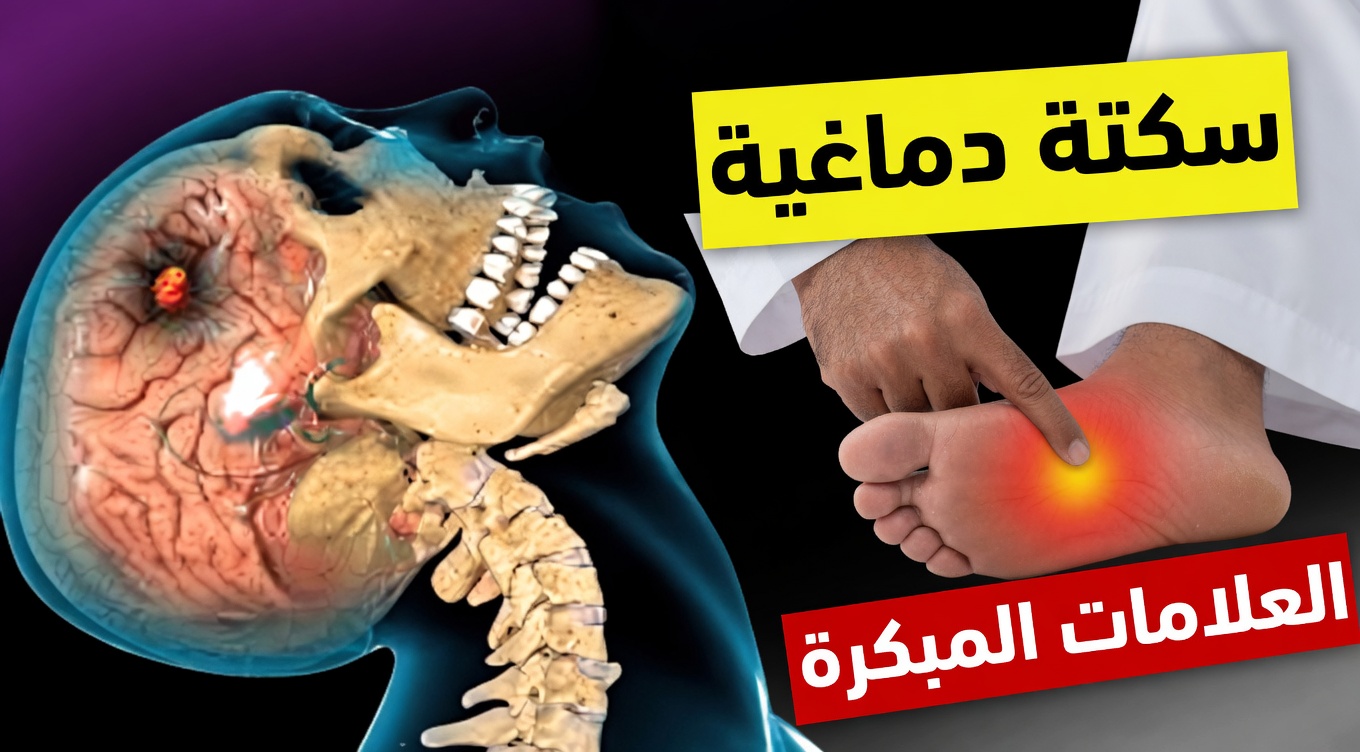٨ علامات تحذيرية للسكتة الدماغية قد تظهر قبلها بشهر + ٩ نصائح فعّالة للوقاية منها