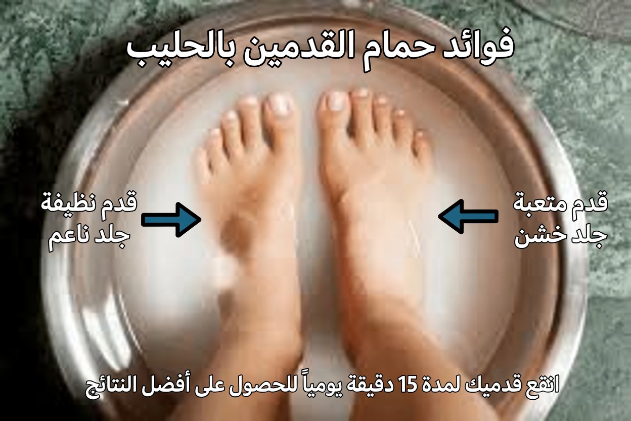 ٥ علاجات منزلية طبيعية لتشققات الكعب تساعد على تنعيم البشرة واستعادة راحة القدم