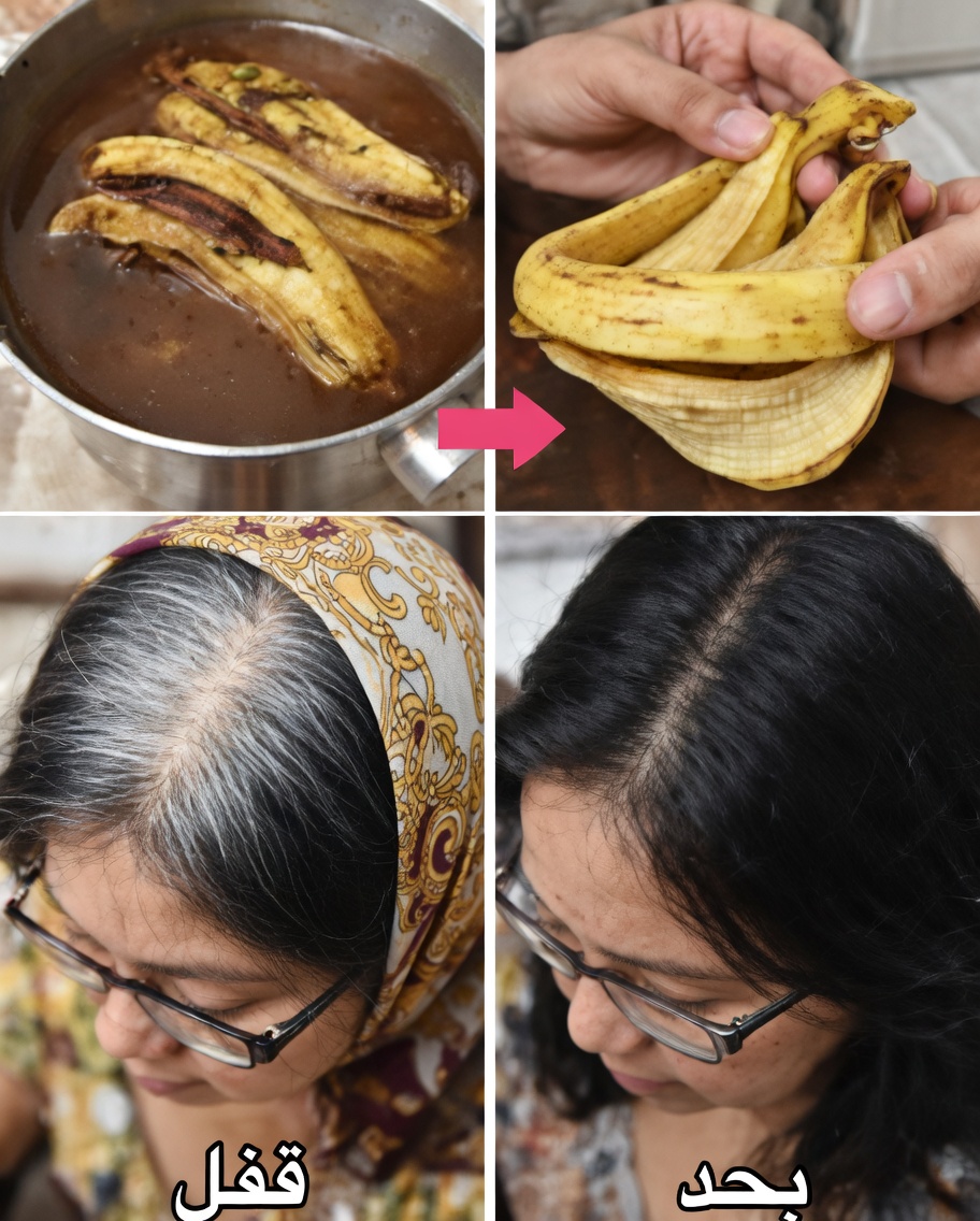 تحويل الشعر الأبيض إلى أسود طبيعيًا في 3 دقائق فقط وتطويل الشعر بسرعة بقشر الموز
