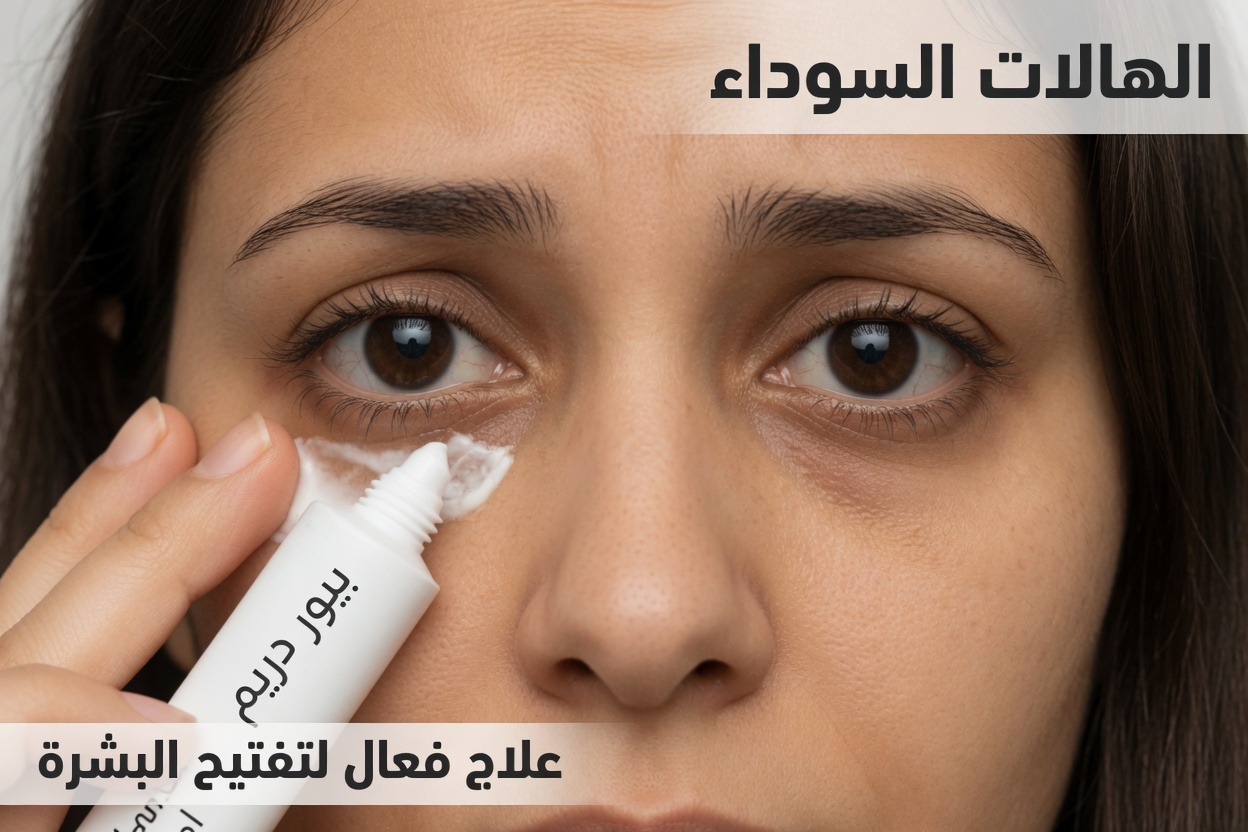 تخلّص من أكياس تحت العين في 3 أيام فقط: خطوات طبيعية بسيطة لتقليل الهالات السوداء والانتفاخ والخطوط الدقيقة