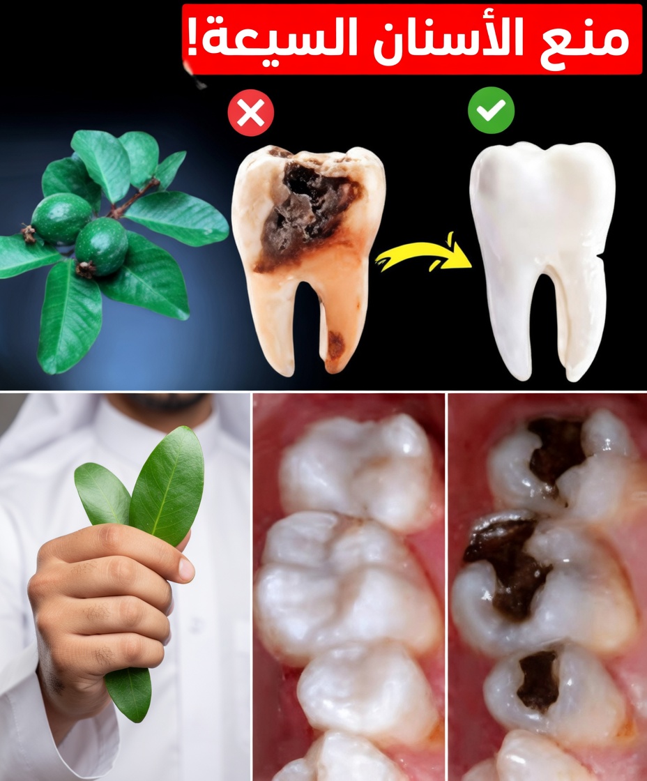 أفضل 3 طرق طبيعية لدعم صحة الأسنان باستخدام أوراق الجوافة – بسيطة وفعّالة من حيث التكلفة!