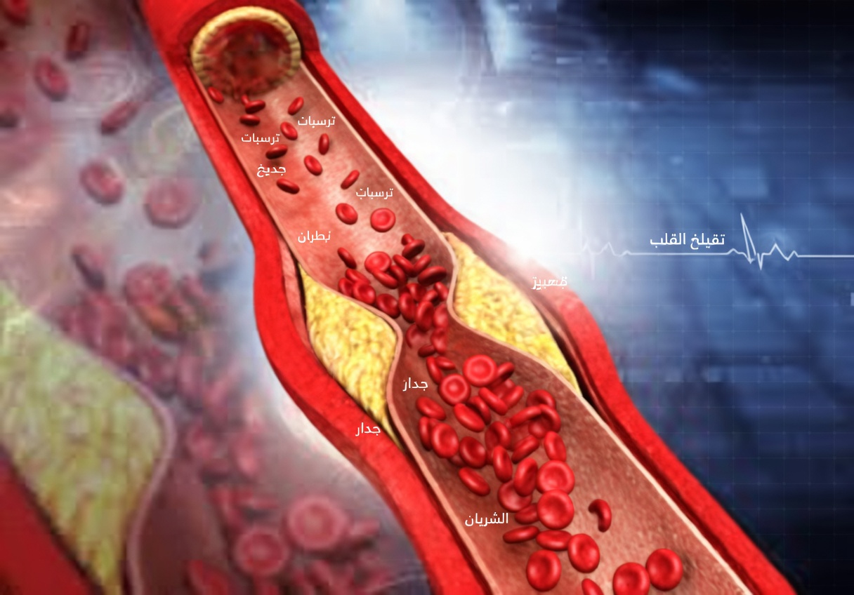 لا تتجاهل هذه العلامات التحذيرية العشر التي قد تشير إلى انسداد شرايينك – الكشف المبكر مهم