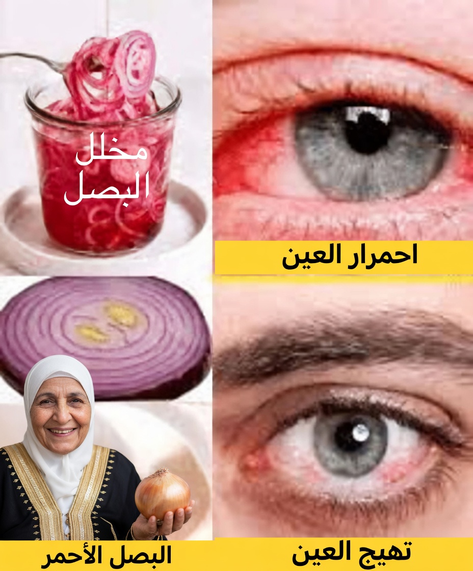 البصل للعناية بالعين: استكشاف اتجاه العلاج التقليدي لمدة 5 أيام وطرق أكثر أمانًا لدعم راحة العين