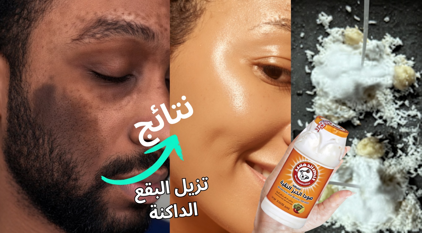 كيفية وضع صودا الخبز على وجهك: 3 طرق فعّالة