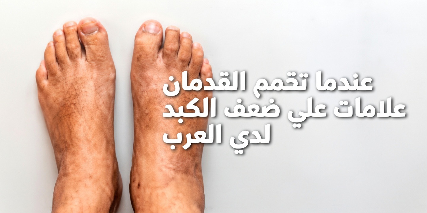 كيف تُحذّرك قدماك من مشكلات الكبد: لا تفوّت هذه العلامات الدقيقة