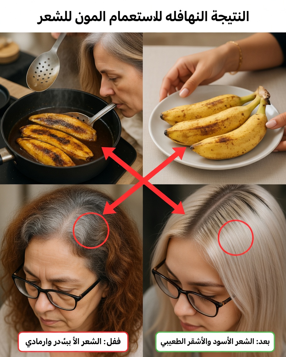 اكتشفي الإمكانات الخفية لقشور الموز للحصول على شعر أكثر صحة ومظهراً أقوى