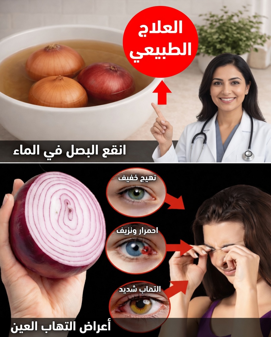 هل يمكن لعصير البصل أن يدعم صحة العينين بلطف؟ نصيحة طبيعية تستحق الاستكشاف