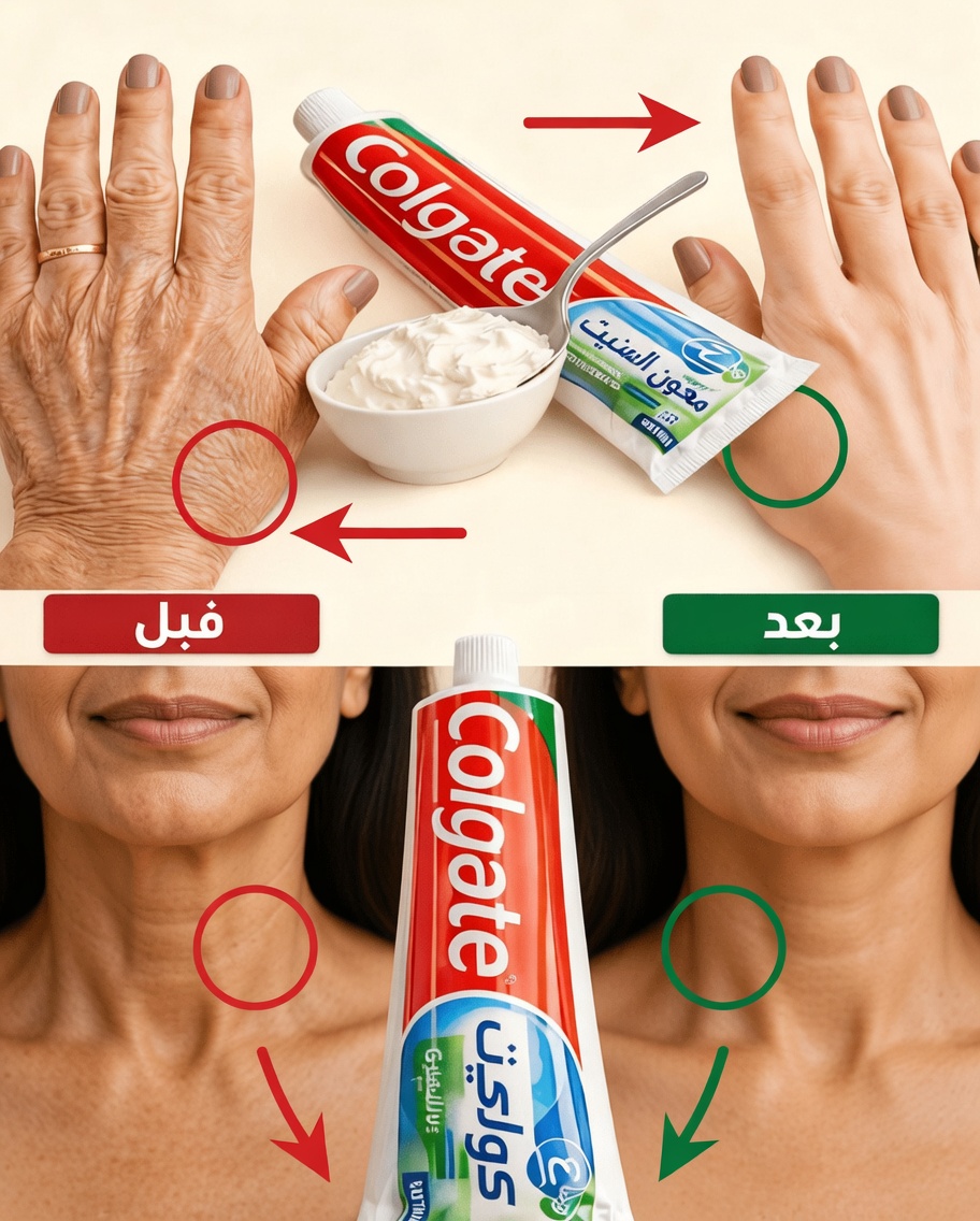 "يبدو وكأنني خضعت لإجراء تجميلي": العلاج المنزلي الذي يحوّل اليدين والذراعين