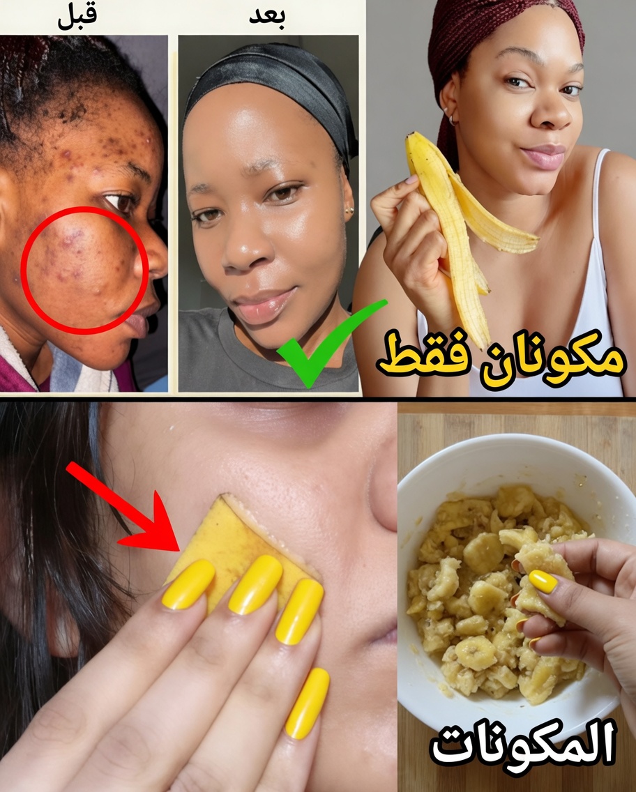 7 طرق طبيعية لتنعيم الخطوط الدقيقة وتعزيز إشراقة البشرة باستخدام قشور الموز