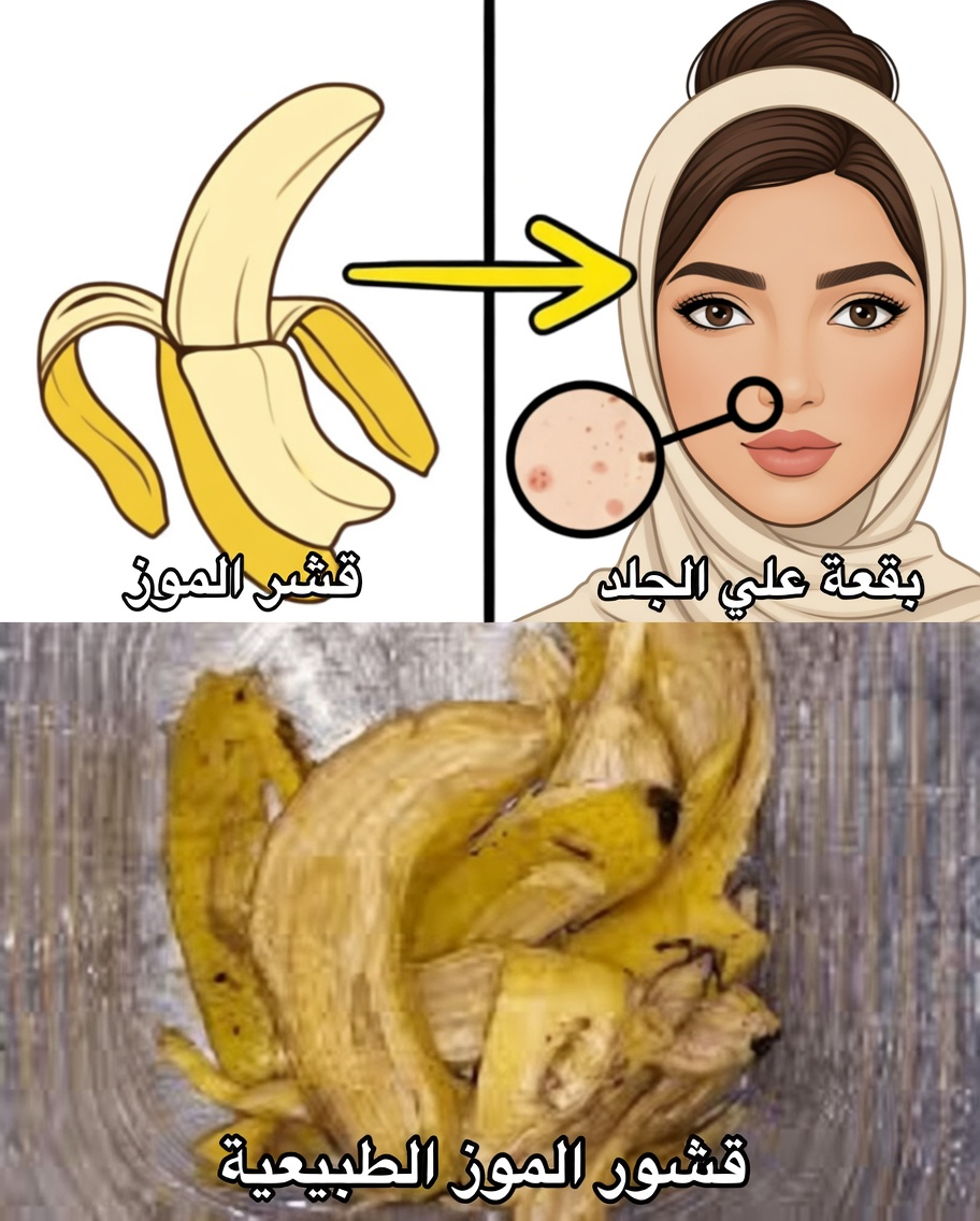 7 طرق طبيعية لتنعيم الخطوط الدقيقة وتعزيز إشراقة البشرة باستخدام قشور الموز