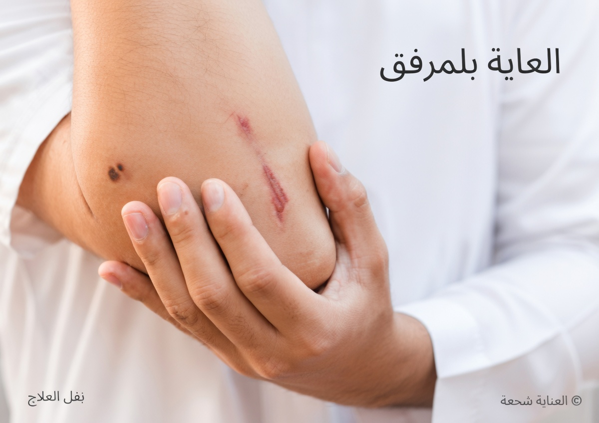 8 علامات غريبة على أن فيتامين د لديك منخفض بشكل خطير – معظم الناس يتجاهلونها حتى فوات الأوان