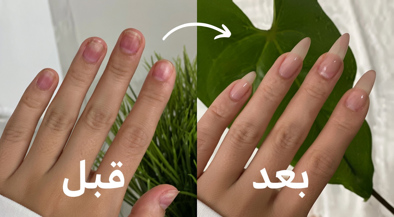 كيفية إطالة أظافرك وتقويتها بشكل ملحوظ في 10 أيام فقط بشكل طبيعي