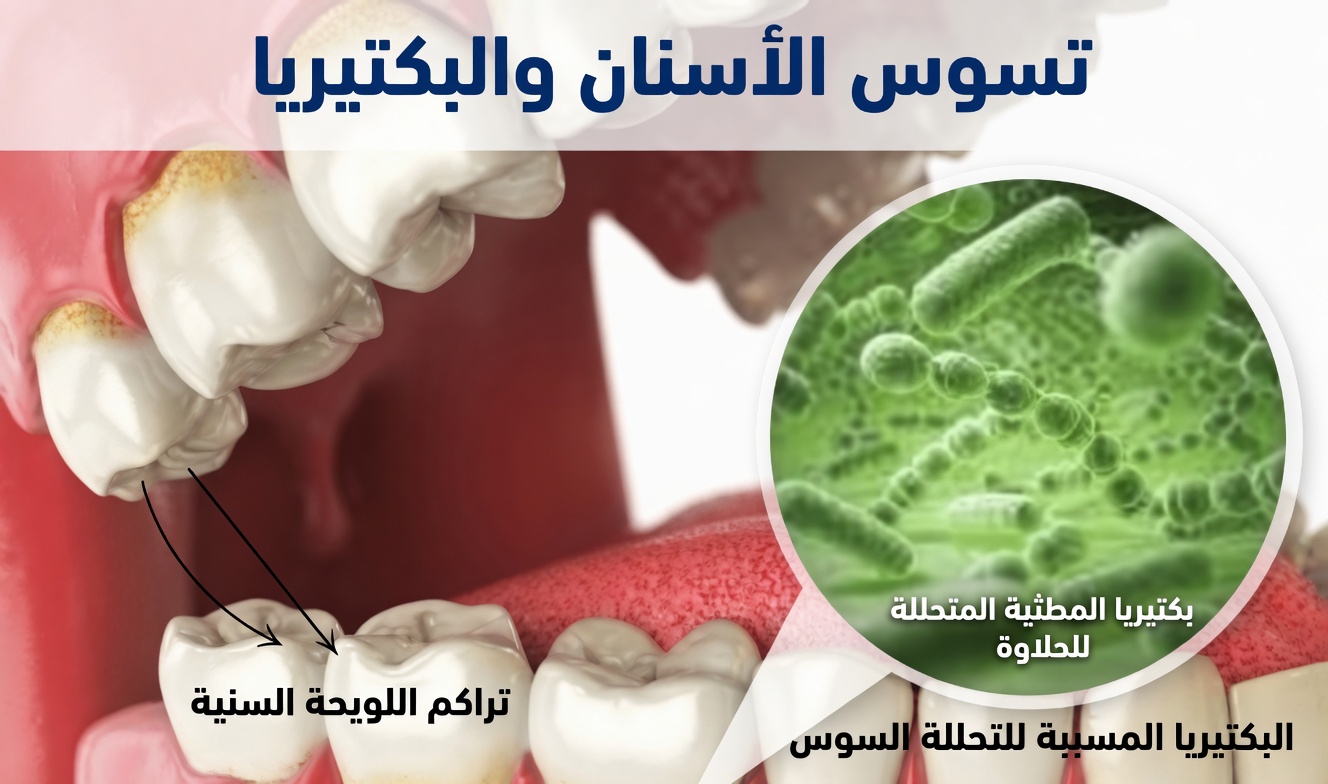 كيف يمكن للريحان المقدس (التولسي) أن يدعم بشكل طبيعي أسنانًا أقوى، ولثةً أكثر صحة، ونفسًا أكثر انتعاشًا، والوقاية من التسوس