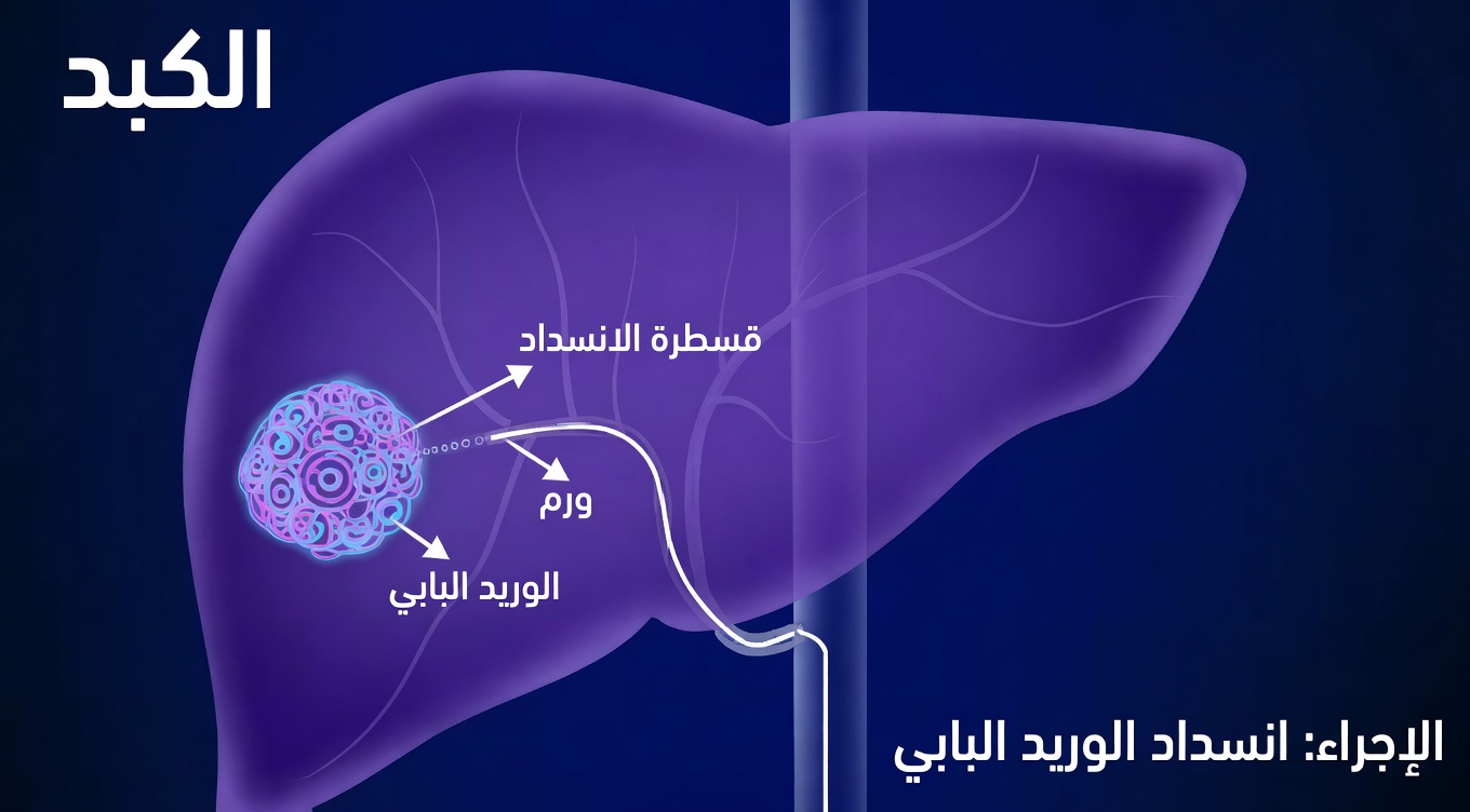 17 علامة صامتة على أن كبدك يستغيث طلبًا للعناية
