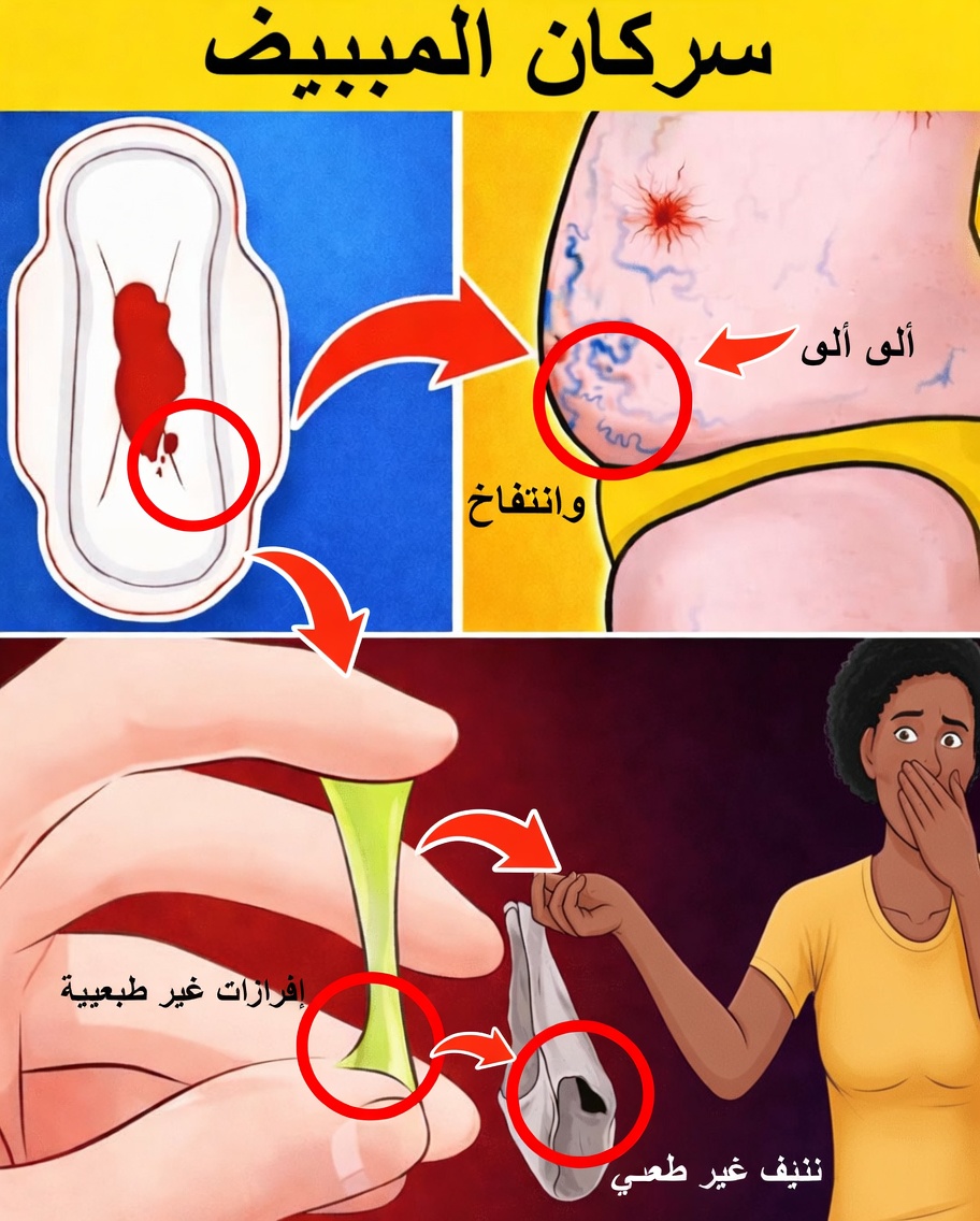 8 علامات صامتة لسرطان المبيض يجب على كل امرأة معرفتها (ولماذا الوعي المبكر ينقذ الأرواح)