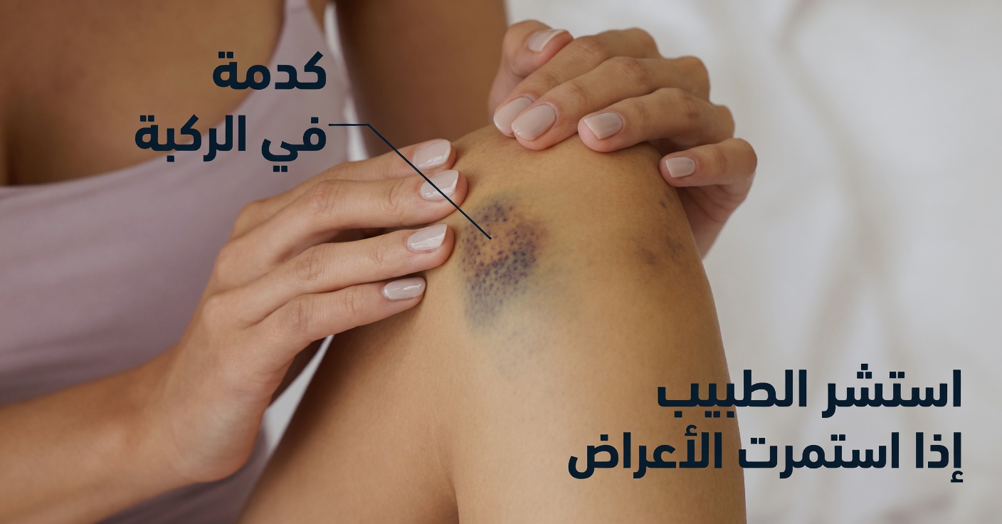 11 علامة غريبة لتلف الكبد لا يجب تجاهلها