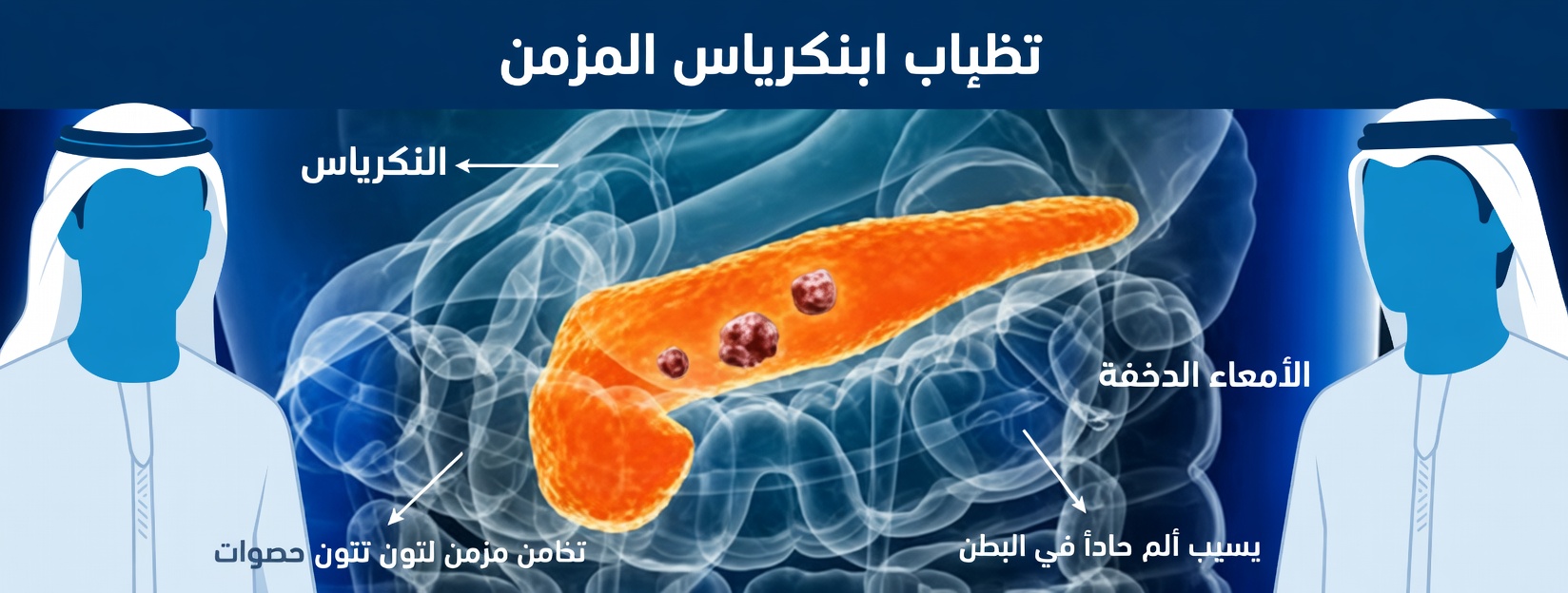 12 علامة تحذيرية مبكرة لسرطان البنكرياس لا يجب تجاهلها أبدًا وكيفية التعرّف عليها