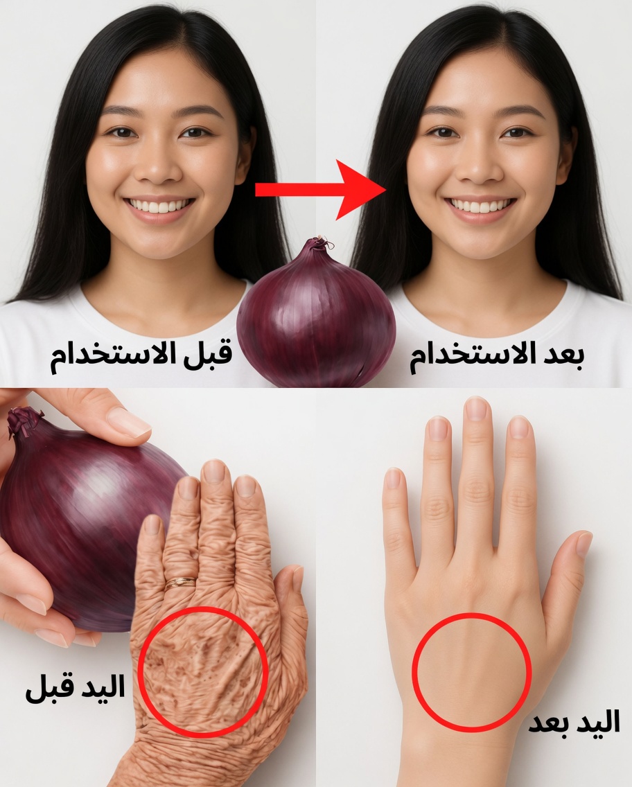 كبار السن، ابشروا بصَرّ حبة بصل أحمر واحدة الليلة وادهنوا هذا القناع الأرجواني على وجهكم—شاهدوا التجاعيد العميقة تتلاشى بنسبة 38% والبشرة تتوهج كأنها في الخمسين خلال 10 ليالٍ فقط